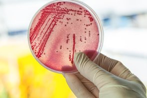 Petri dish with bacteria Petri dish with bacteria