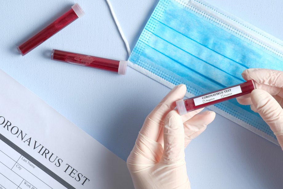 Coronavirus blood test concept. Doctor hands in medical gloves holding test tube with blood for Coronavirus analysis over laboratory desk. 2019-nCoV Coronavirus originating in Wuhan, China