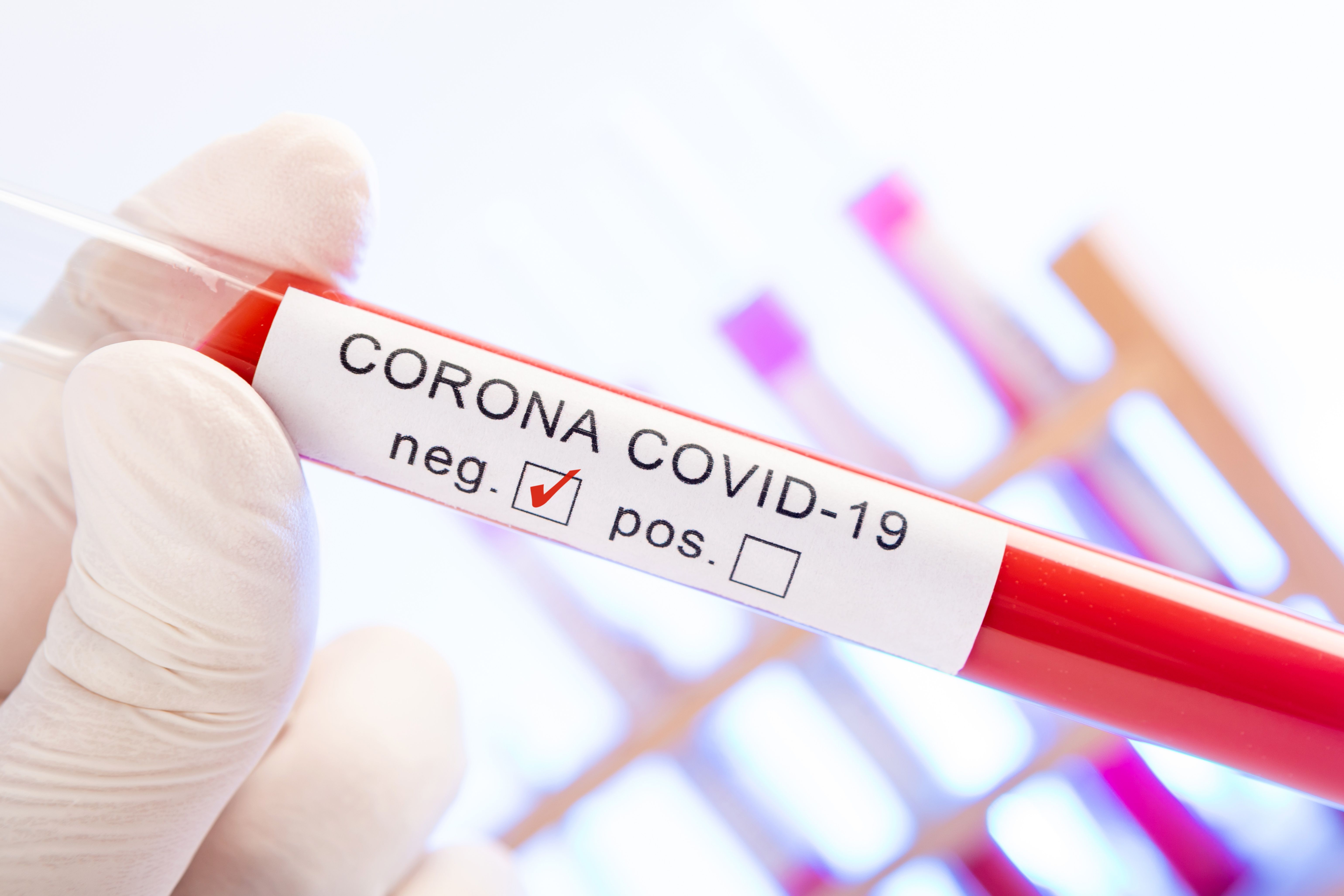 CORONA Virus