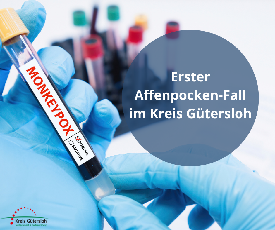 Canva-Grafik Affenpocken Canva-Grafik Affenpocken